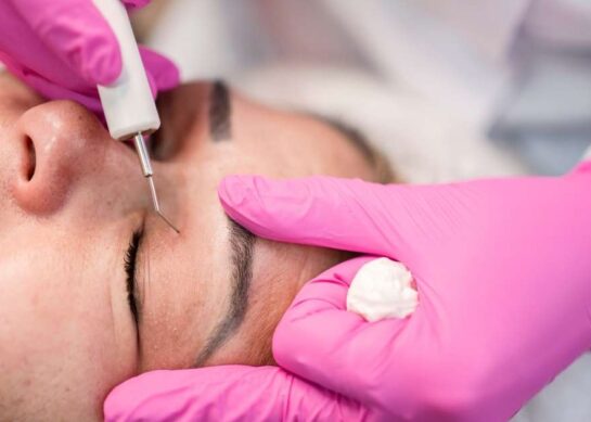 Blefaroplastyka przed i po: jakie są efekty zabiegu?
