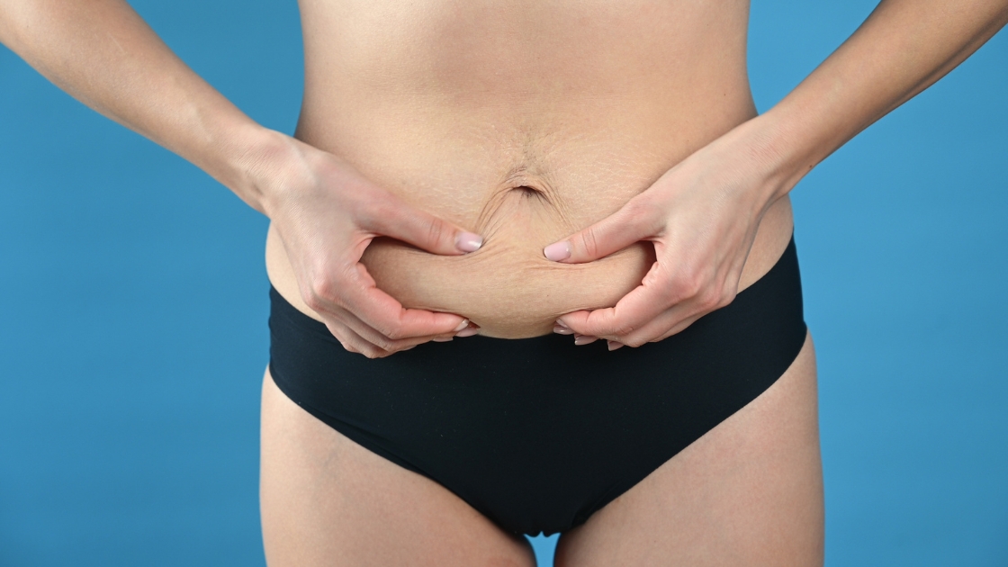 W jaki sposób przygotować się do zabiegu mini abdominoplastyki