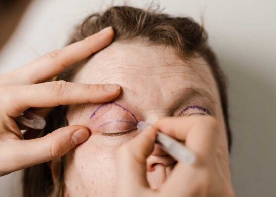 Blefaroplastyka w Warszawie: Czy warto zrobić zabieg?